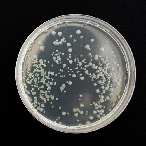 vetrino brettanomyces